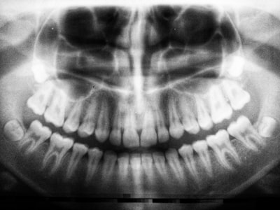 Planitud y alineación de gradientes: exploración espectral para aprendizaje multi-distribución