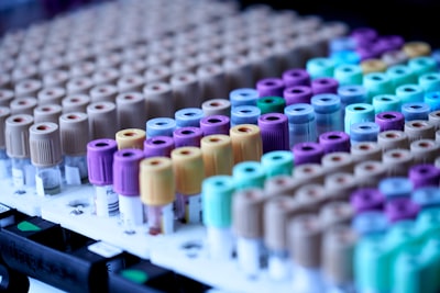 LSTM y Transformer logran 98% de precisión en predicción de elución