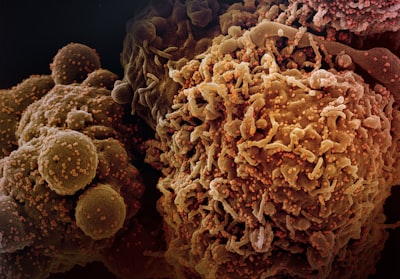 ¿El cáncer revela pistas para tratar Alzheimer?