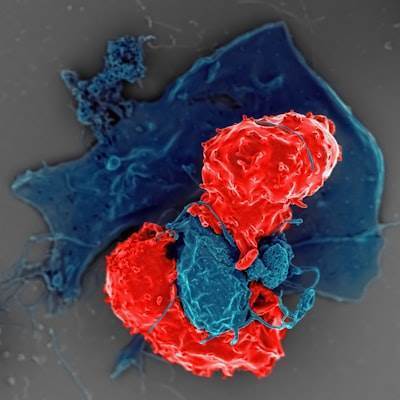 Mapeo espacial preciso e inmunomodulación en organoides de islotes iPSC