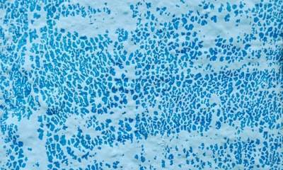 Predicting Systemic Inflammation Response Using Microbial Dysbiosis Signature in Periodontitis