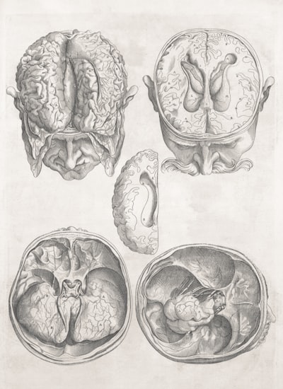 Representaciones consistentes de trastornos cerebrales con aprendizaje multi-atlas
