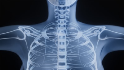 Diagnóstico de fracturas cervicales con IA y proyecciones