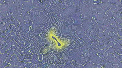 Visualización temporal de datos biomédicos con IRIS