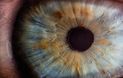 Aprendiendo a ver con implantes epirretinianos y aprendizaje por refuerzo