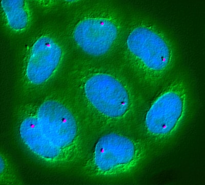 Densificación inducida por células y formación de anclajes en matrices extracelulares fibrosas con redes neuronales biomiméticas informadas por la física