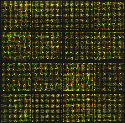 Perfil de carga de exosomas impulsado por aprendizaje profundo para la detección temprana de biomarcadores de Alzheimer