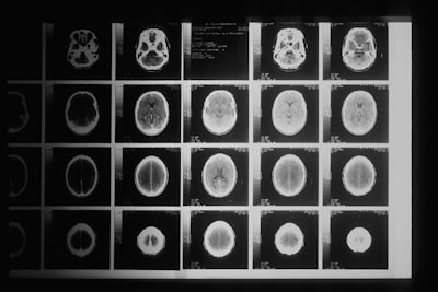  Flow matching con prioridades de contexto para dinámicas fMRI fuera de distribución