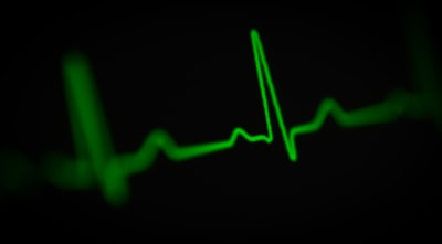  Cómo monitorear tu app Node.js con checks de uptime y heartbeat (gratis con Vigilmon)