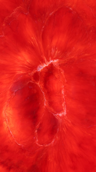 Ajuste fino de un modelo base de ECG para predecir los resultados de la angiografía coronaria por TC