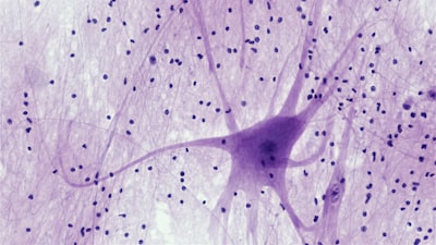 Velocidades de convergencia superrápidas para clasificadores de redes neuronales bajo la condición de margen duro