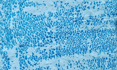 Modelado predictivo del respuesta inflamatoria sistémica a través del huella de disbiosis microbiana en periodontitis